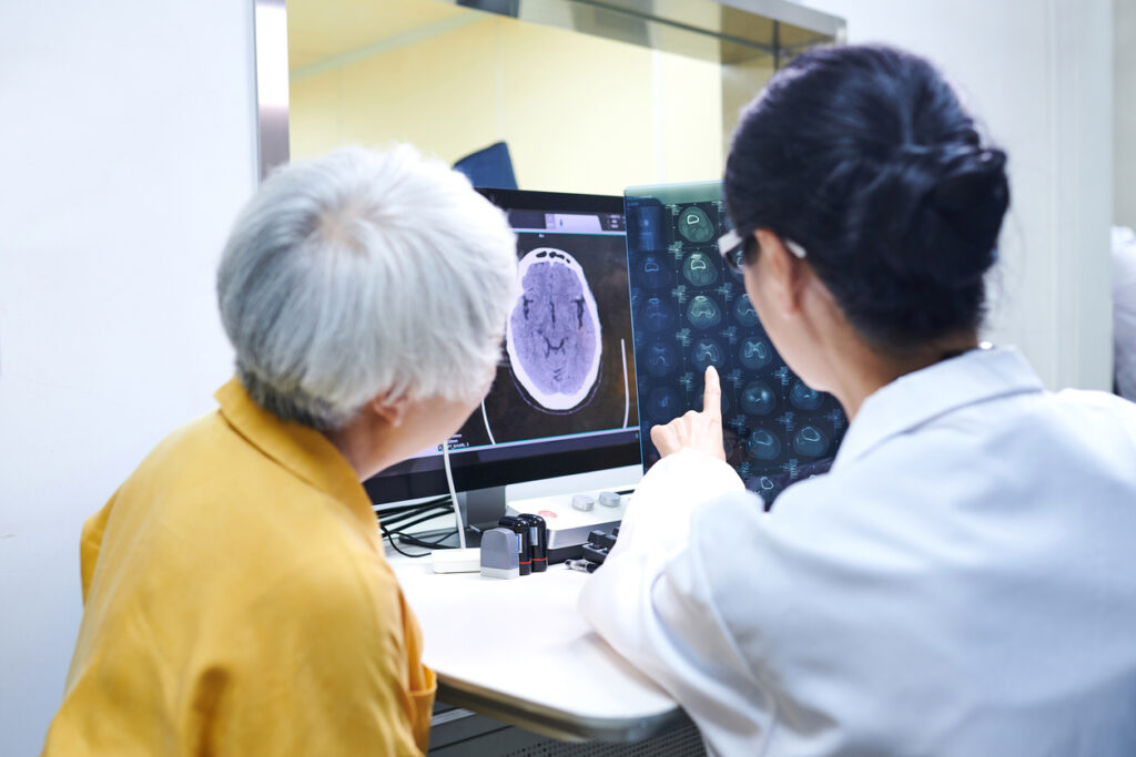 senior and doctor looking at a brain scan